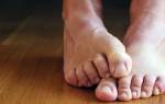 Причина утолщения ногтей на ногах у женщин