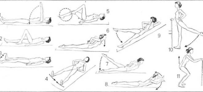 Лечебная гимнастика при артрозе тазобедренного сустава видео