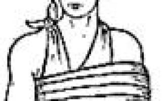 Первая помощь при переломах нижних конечностей