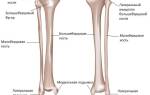 Перелом берцовой кости сколько ходить в гипсе