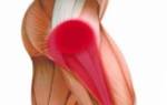 Онемение мышц ноги выше колена