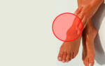 Красные уплотнения на ногах при нажатии больно