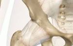Боль в тазовом суставе правой ноги