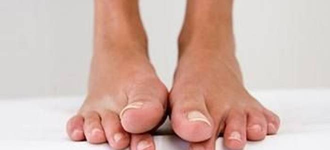 Постоянно немеют ноги