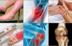 Артрозо артрит тазобедренного сустава симптомы и лечение