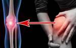 Признаки артрита колена
