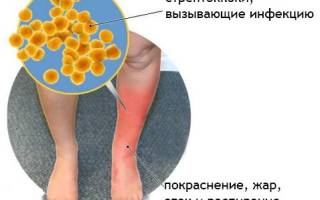 Рожистое воспаление ноги симптомы и лечение мазь