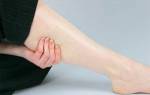 Спазм икроножной мышцы одной ноги что делать