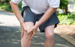 Болит нога сзади колена что делать