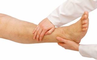 Опухоль ноги ниже колена как лечить