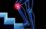 Боль в коленном суставе при ходьбе причины