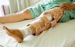 Какие симптомы при переломе ноги
