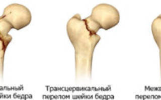 Боль по внутренней поверхности бедра