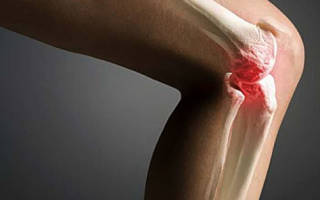 Трещина в колене симптомы