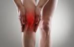 Болит колено какой врач нужен