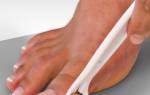 Как лечить натоптыши на пальцах ног