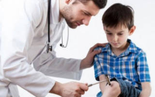Реактивный артрит у детей причины симптомы лечение