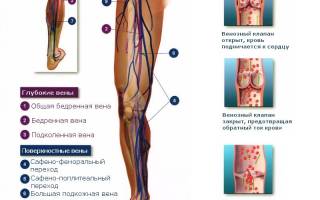 Внутренние вены на ногах симптомы лечение