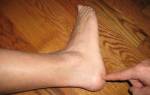 Онемение пятки левой ноги причины и лечение