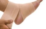 Как лечить растяжение связок на ноге