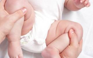 Незрелость тазобедренных суставов у новорожденных тип 2а
